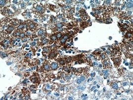Collagen III抗体を用いたパラフィン包埋マウス肝臓組織の免疫組織化学染色