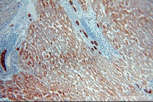 Cytokeratin specific抗体を用いたパラフィン包埋ヒト肝臓の免疫組織化学染色