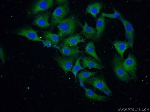 α-シヌクレイン抗体の免疫蛍光染色検証