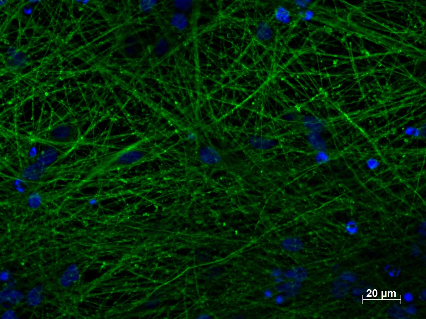 TUBB3抗体を使用したヒトiPS細胞由来培養神経細胞（4%PFA固定、培養期間35日）の免疫蛍光染色