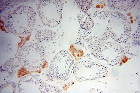 Lin28B-specific抗体の免疫組織化学染色検証