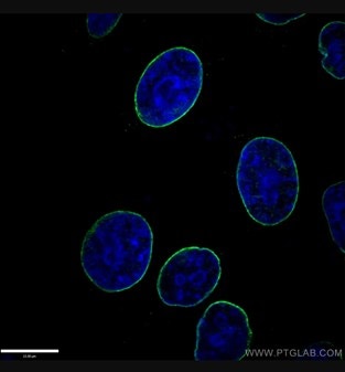 Lamin A/C抗体を使用した核膜の免疫蛍光染色