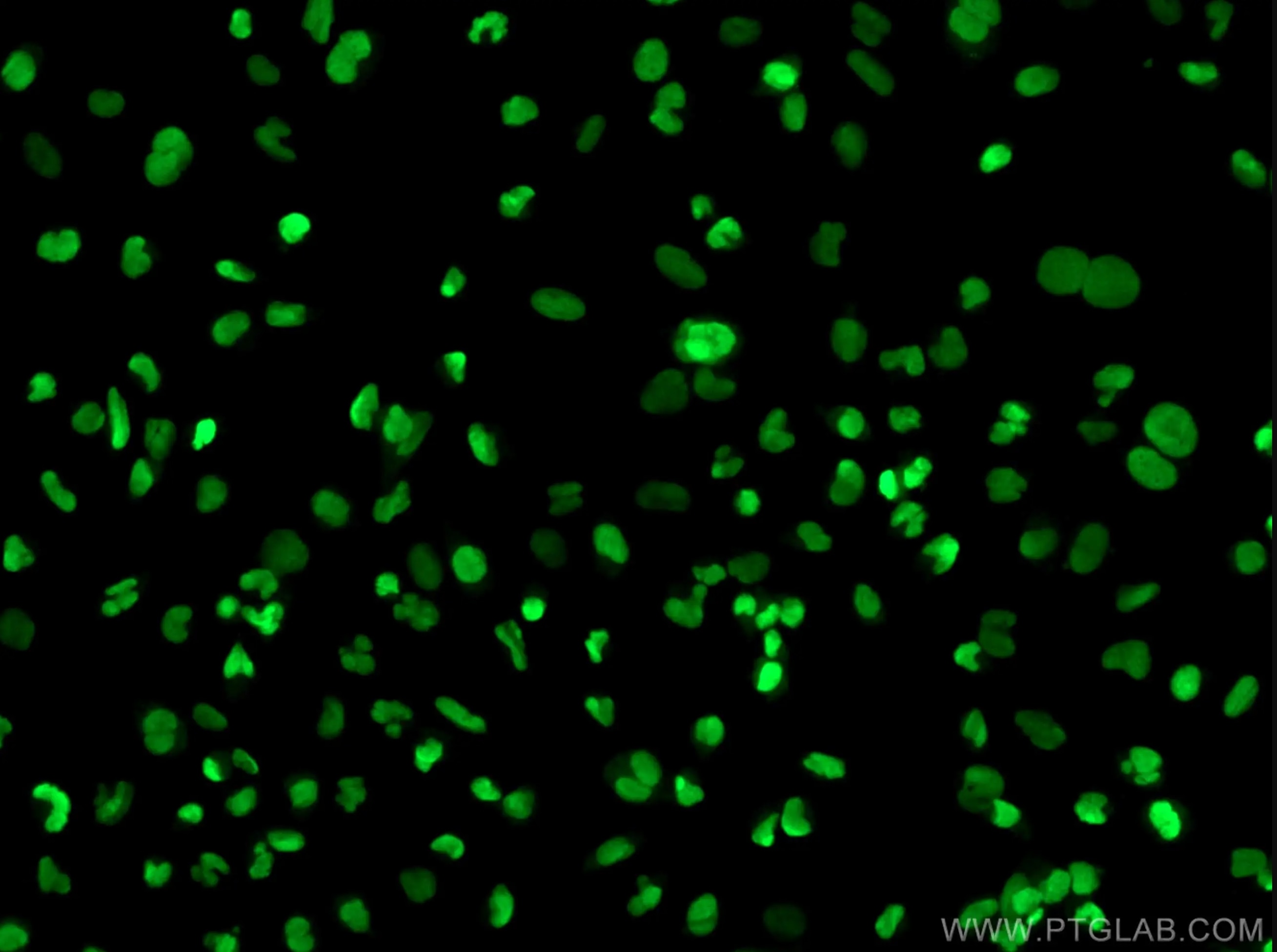 Histone H2A.X抗体を使用した核の免疫蛍光染色