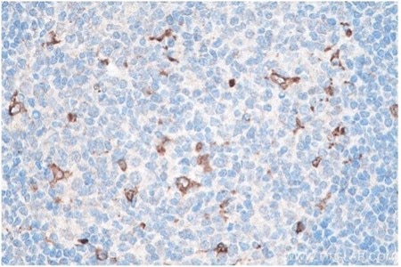 CD68 IHCキットを使用したパラフィン包埋ヒト扁桃炎組織の免疫組織化学染色