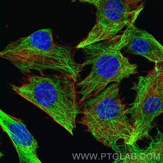 αチューブリン組換え抗体を使用した細胞骨格の免疫蛍光染色