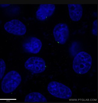 CENPJ抗体を使用した中心体の免疫蛍光染色