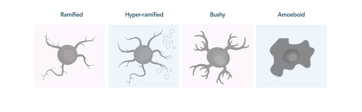 中枢神経系におけるミクログリア細胞の状態のイラスト（ラミファイド型、ハイパーラミファイド型、ブッシー型、アメボイド型）