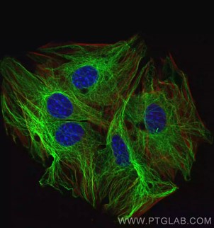 βチューブリン組換え抗体を使用した細胞骨格の免疫蛍光染色