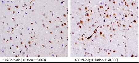 TDP-43抗体を使用したFTLD-U患者脳組織の免疫組織化学染色