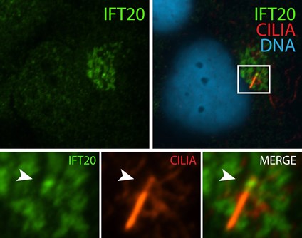 IFT20抗体を使用した不死化ヒト網膜色素上皮細胞の免疫蛍光染色。
