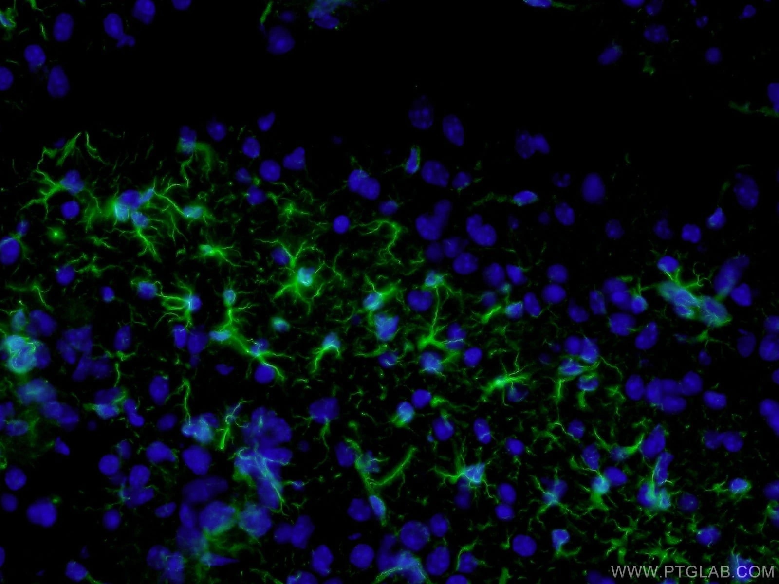 GFAP抗体、Alexa Fluor488標識AffiniPureヤギ抗マウスIgG（H+L）抗体を使用したマウス脳組織（4%PFA固定）の免疫蛍光染色