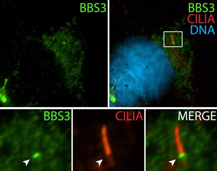 BBS3抗体を使用した不死化ヒト網膜色素上皮細胞の免疫蛍光染色。