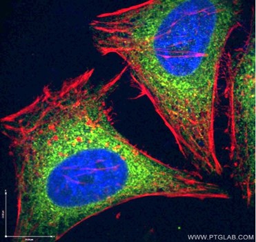 小胞体マーカーによる免疫蛍光染色像