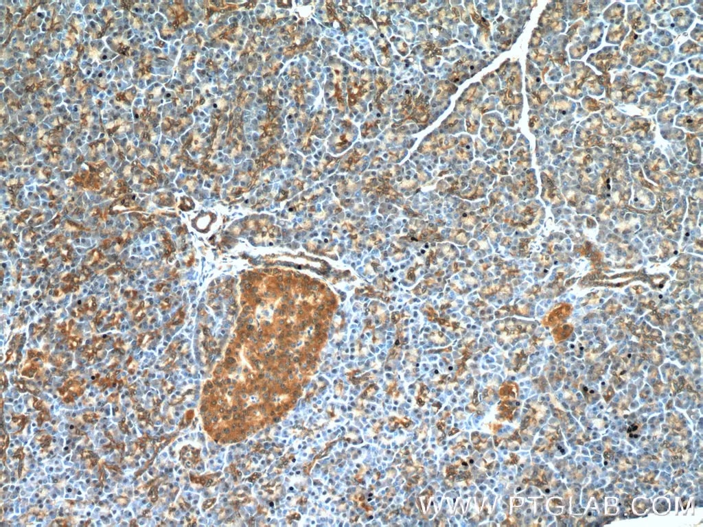 RIP3抗体を使用したパラフィン包埋ヒト膵臓組織スライドの免疫組織化学染色