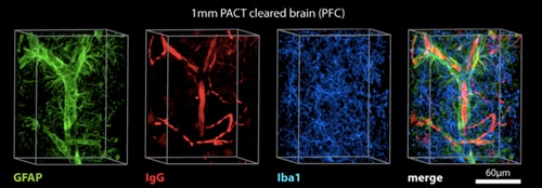 GFAP抗体、抗マウスIgG抗体、Iba1抗体を使用した、1mmにスライスしたPACT透明化マウス脳前頭前皮質の免疫蛍光染色