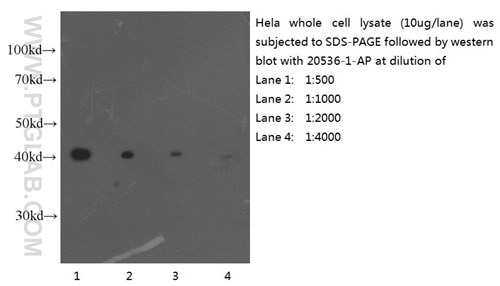 異なる濃度のβ-アクチン抗体を使用したHeLa細胞ライセートのウェスタンブロット（希釈倍率によって検出シグナルの強度が変化）