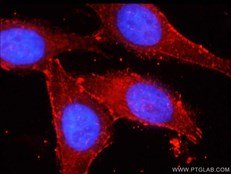 beta-catenin抗体を用いたHepG2細胞の免疫蛍光染色像
