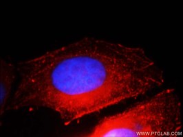 E-Cadherin抗体を用いたHepG2細胞の免疫蛍光染色像