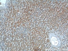 Smad7抗体を用いたパラフィン包埋ヒト肝臓組織の免疫組織化学染色