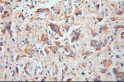 TOM20抗体を使用したパラフィン包埋ヒト神経膠腫の免疫組織化学染色