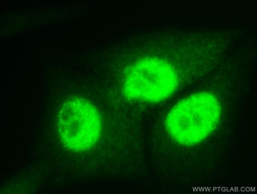 抗PCNA抗体およびFITC標識ロバ抗ウサギIgGを使用したHepG2細胞の免疫蛍光染色