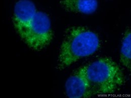 GABARAPL1-Specific抗体の免疫蛍光染色検証