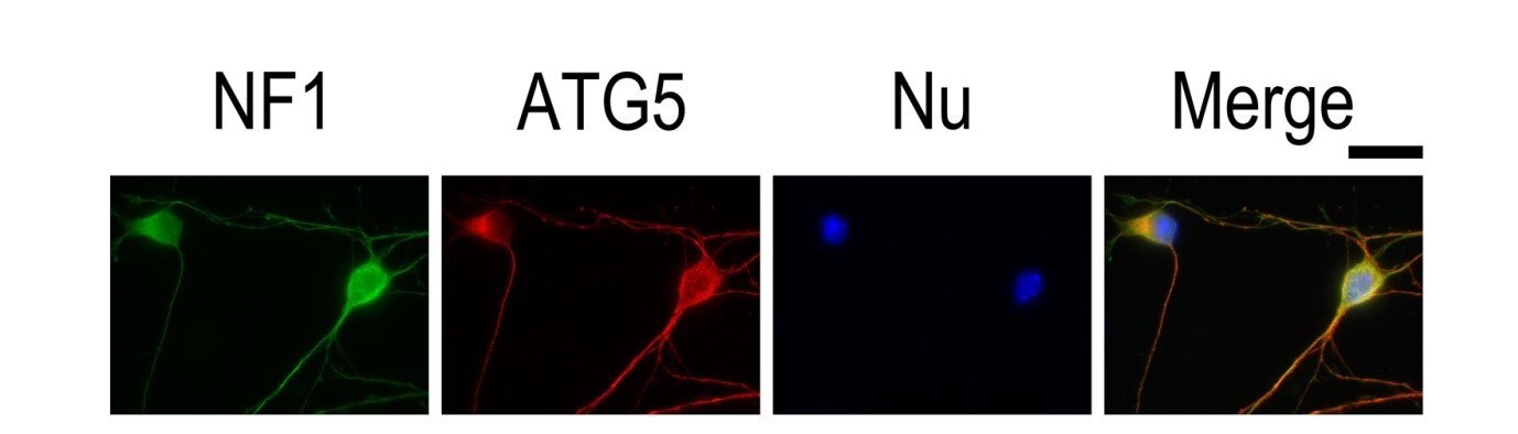 ヒントとコツ 免疫蛍光 If 染色実験をするための9つのこと Proteintech Group 抗体 Elisaキット