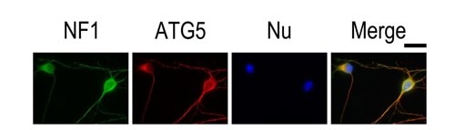 ATG5抗体を使用したE15齢マウスの皮質ニューロンのマルチプレックス免疫蛍光染色（NF、ATG5、核、Merge画像）