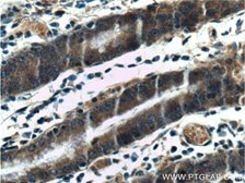 Beclin 1抗体を使用したパラフィン包埋ヒト胃組織スライドの免疫組織化学染色