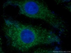 パーキン抗体およびAlexa Fluor 488標識AffiniPure ヤギ抗ウサギIgGを使用したSH-SY5Y細胞の免疫蛍光染色