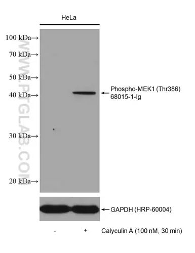 Phospho-MEK1 (Thr386)抗体およびGAPDH抗体を用いた、無処理のHeLa細胞およびCalyculin A処理したHeLa細胞のウェスタンブロット