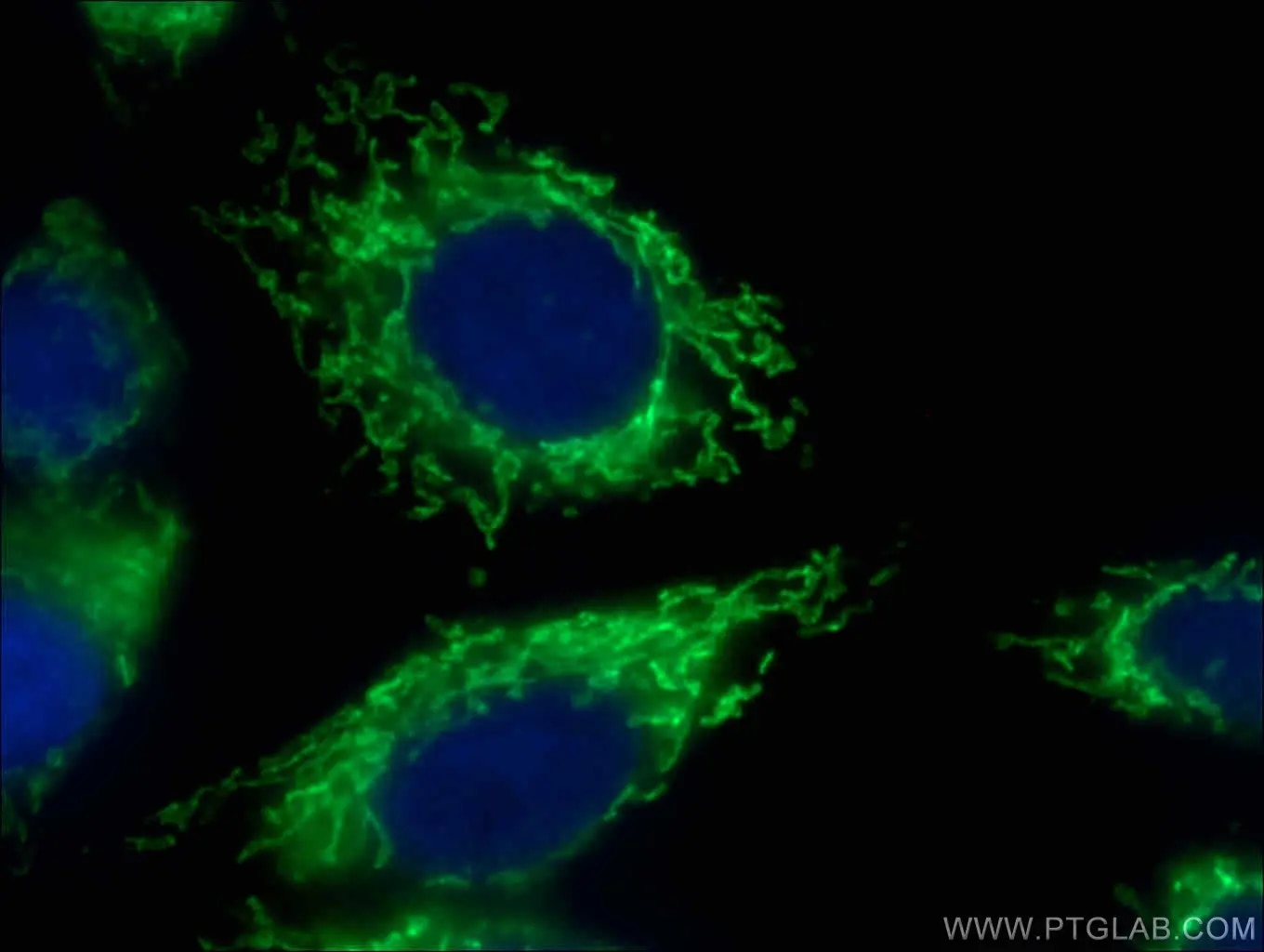 COXIV抗体およびAlexa Fluor 488標識AffiniPureヤギ抗ウサギIgGを使用したHepG2細胞の免疫蛍光染色