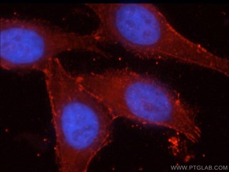 CTNNB1抗体の免疫蛍光染色検証