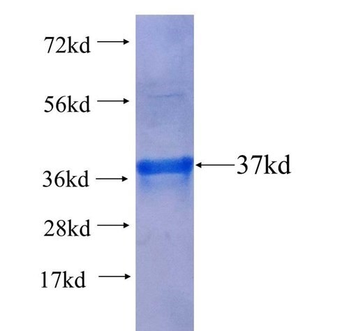ヒトDNMT3B-GST融合タンパク質のSDS-PAGE
