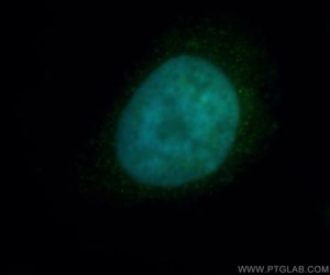 HDAC2抗体およびFITC標識ロバ抗ウサギIgGを使用したHeLa細胞の免疫蛍光染色