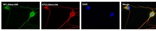 ATG5抗体およびNF1抗体を使用した4%PFA固定0.2% Triton X-100透過処理E15マウス皮質ニューロンの免疫蛍光染色（NF1 Alexa488、ATG5 Alexa594、DAPI、Merge画像）