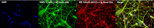MAP2抗体およびTUBB3抗体を使用したヒトiPS細胞由来神経培養物の免疫蛍光染色（DAPI、MAP2、TUBB、Meerge画像）
