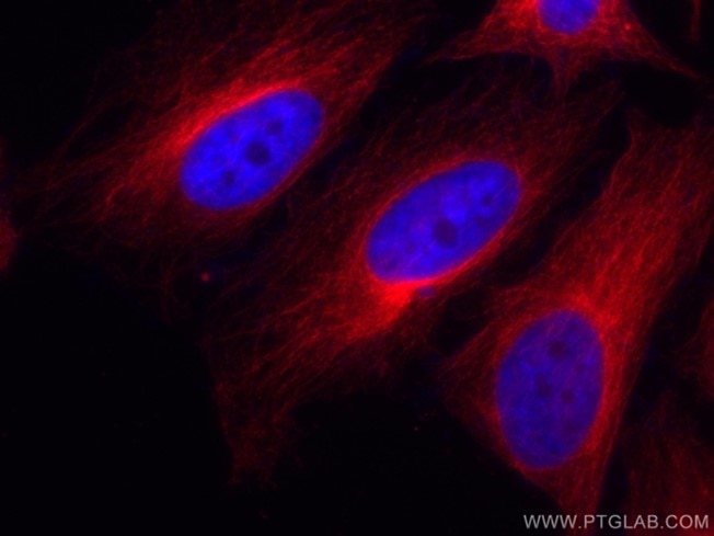 CoraLite®標識Alpha Tubulin抗体を使用した4%PFA固定HeLa細胞の免疫蛍光染色