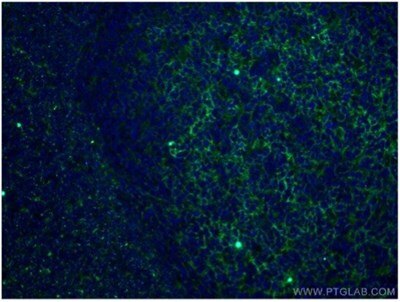 CD11B/Integrin alpha M抗体およびCoraLite®488標識AffiniPureヤギ抗マウスIgGを使用した4%PFA固定ヒト扁桃炎組織の免疫蛍光染色