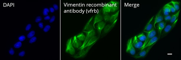 MDCK細胞の免疫染色（DAPI染色、Vimentin VHH-ウサギIgG融合組換え抗体およびanti-human IgG/anti-rabbit Nano Secondary、Merge画像）