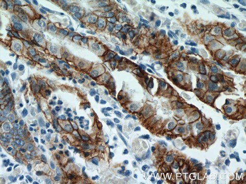 CA9抗体を使用したパラフィン包埋ヒト胃組織スライドの免疫組織化学