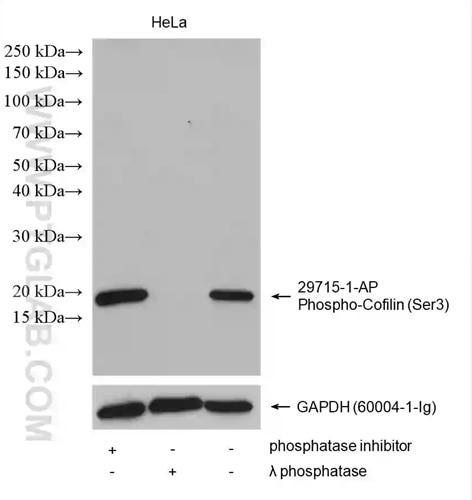 Phospho-Cofilin（Ser3）抗体およびGAPDH抗体を用いたHeLa細胞ライセートのウェスタンブロット