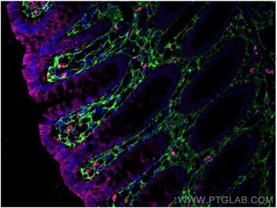 CoraLite®594標識CD68抗体、CoraLite®488標識Cytokeratin 20抗体、Ⅲ型コラーゲン（N-terminal）抗体を使用した4%PFA固定ヒト結腸組織の免疫蛍光染色