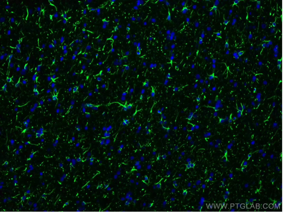 GFAP抗体・CoraLite® 488標識二次抗体を使用したラット脳組織の免疫蛍光染色。