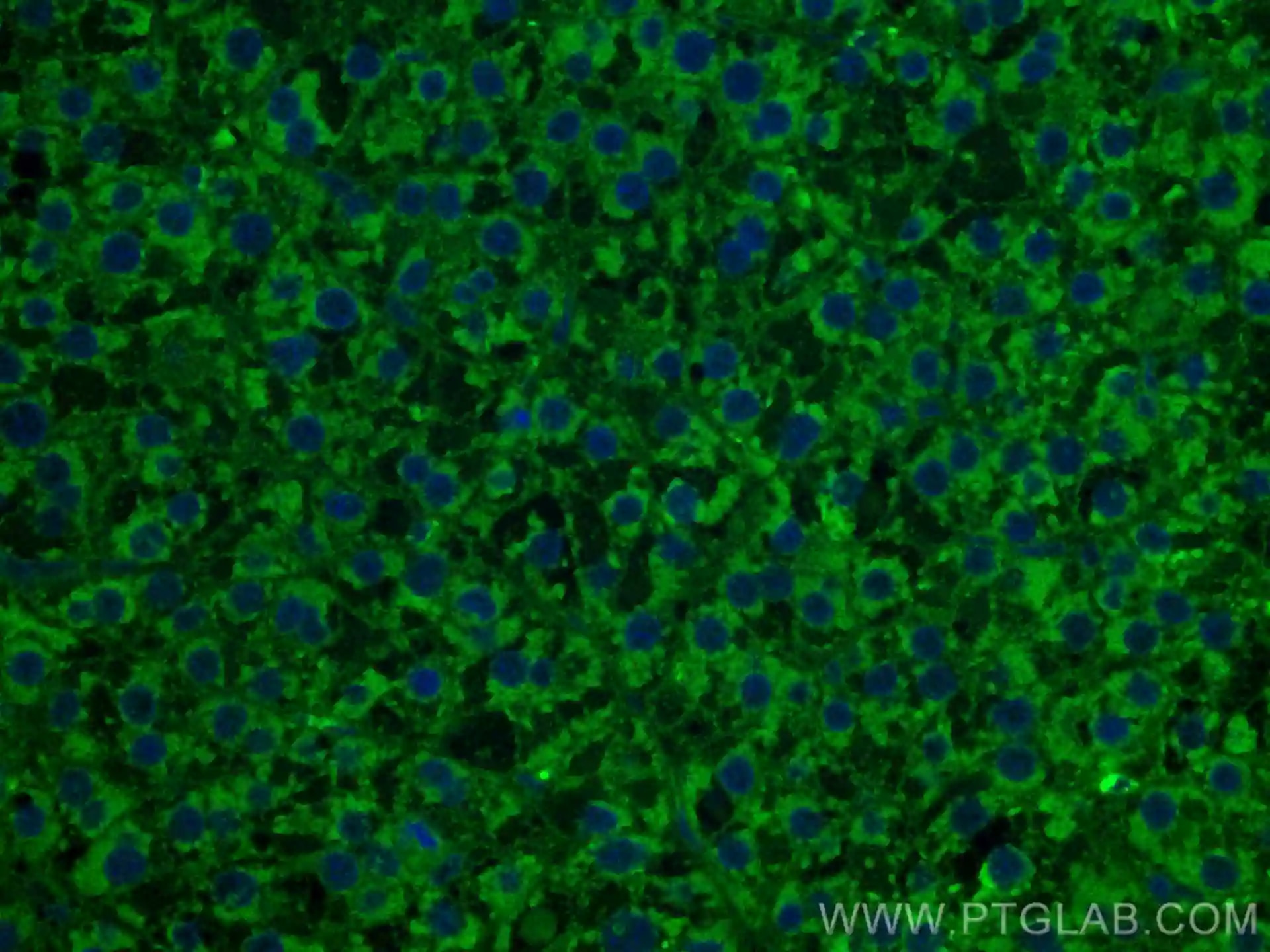 CoraLite® Plus 488 TNFR1抗体を使用した4%PFA固定ヒト肝臓がん組織の免疫蛍光染色