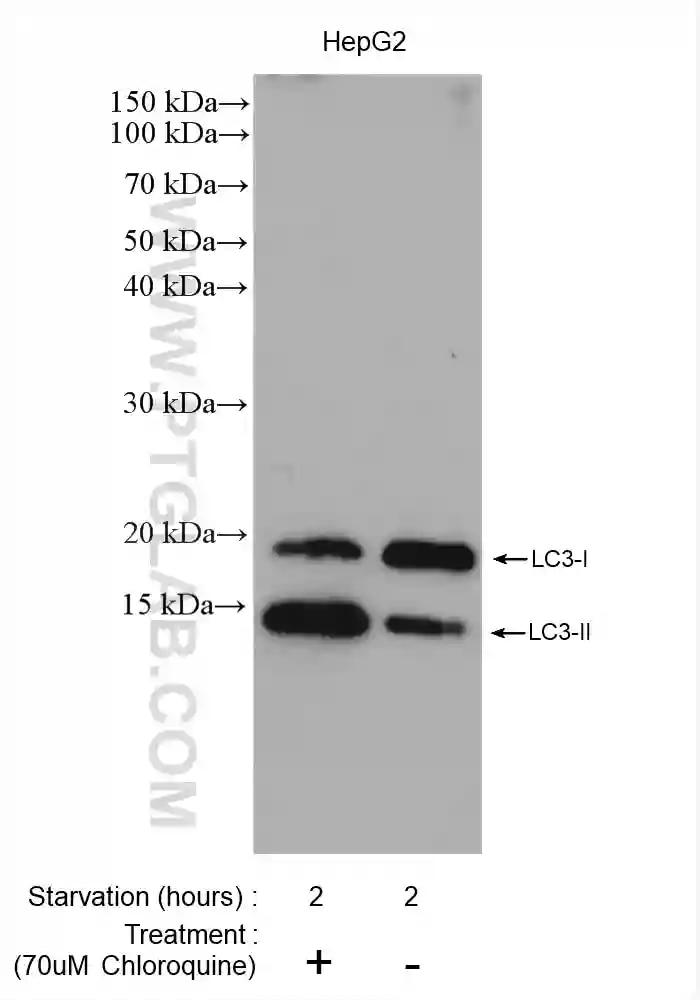 LC3抗体を使用したクロロキン処理/無処理HepG2細胞のウェスタンブロット
