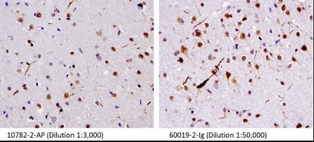 TDP-43抗体を使用したFTLD-U患者脳組織の免疫組織化学染色