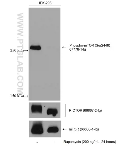 Phospho-mTOR (Ser2448)抗体、RICTOR抗体、mTOR抗体を用いた無処理のHEK-293細胞およびラパマイシン処理したHeLa細胞のウェスタンブロット