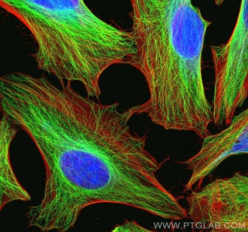 細胞骨格マーカーによる免疫蛍光染色像